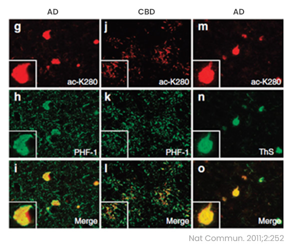 Unveiling the Crucial Role of Tau-K280 Acetylation in Disease Pathogenesis