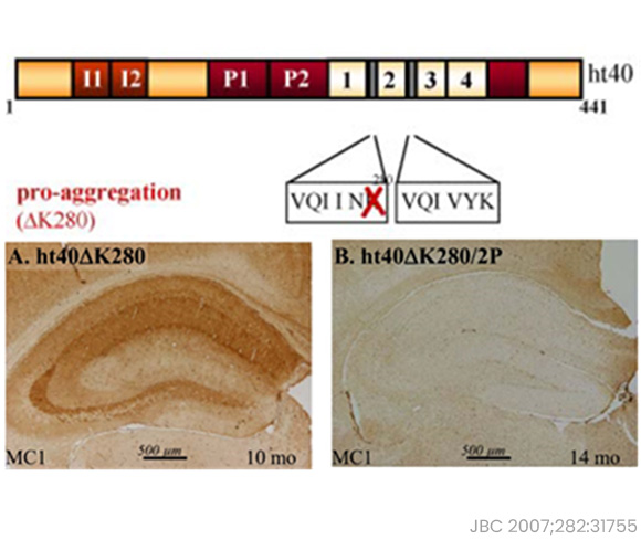 Unveiling the Crucial Role of Tau-K280 Acetylation in Disease Pathogenesis